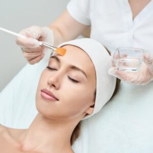 Read more about the article Chemical Peels